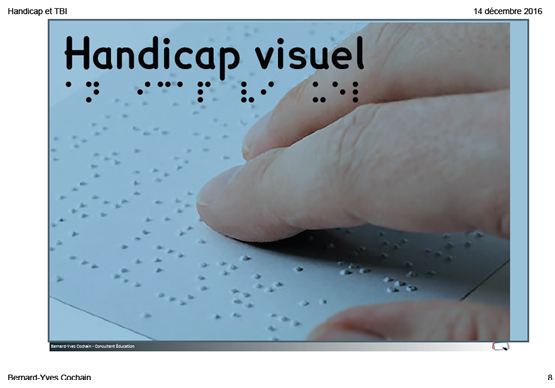 handicap visuel